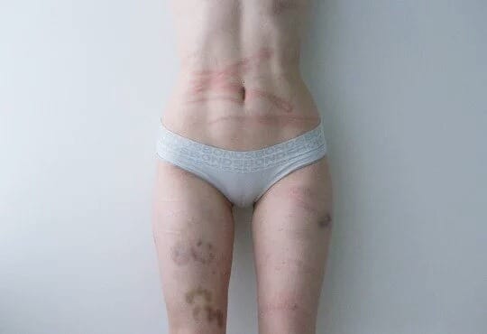 (Untitled)