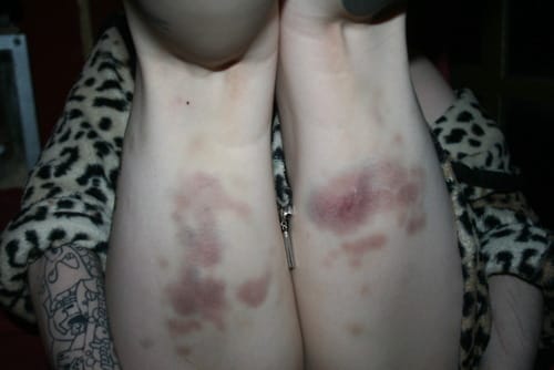 (Untitled)